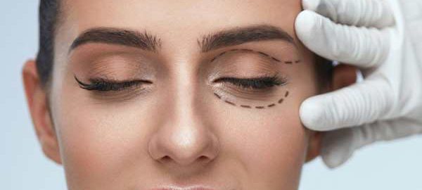 Eyelid Surgery in Kanpur
