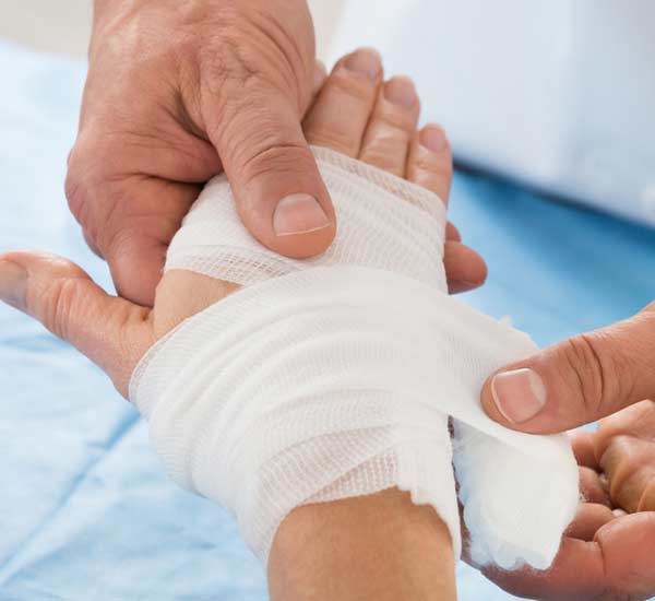 Burns Treatment in Kanpur